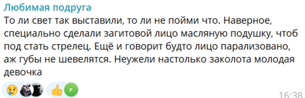  «Лицо парализовано, аж губы не шевелятся!» Что не так с внешним видом 22-летней Алины Загитовой